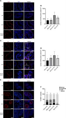 Sertoli and Germ Cells Within Atrophic Seminiferous Tubules of Men With Non-Obstructive Azoospermia